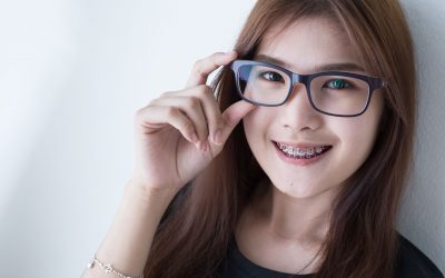 Things to Know Before Getting Braces In Singapore