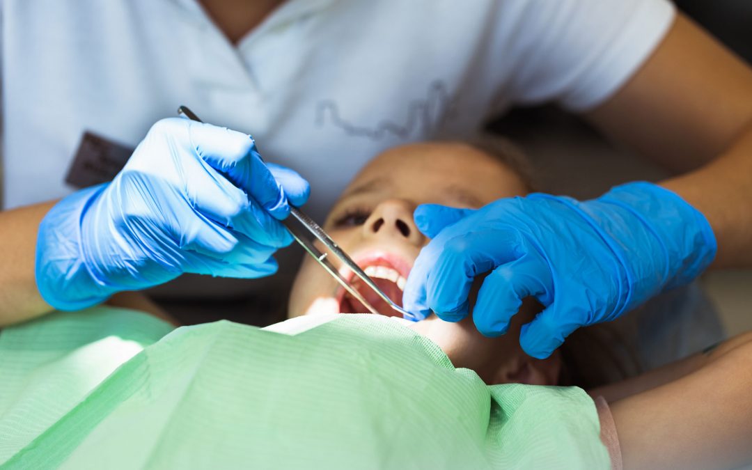 Getting Fluoride Treatment? Here’s What You Need To Know.